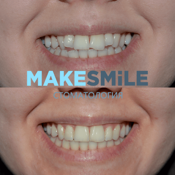 Изображение №9 компании Make smile