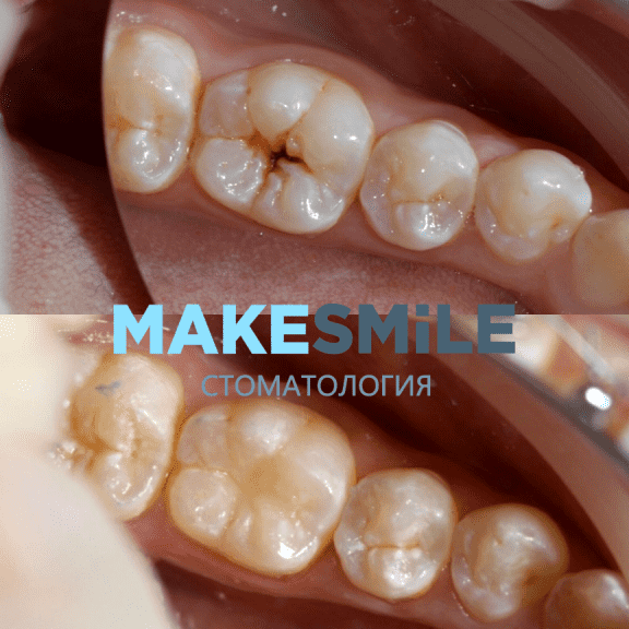 Изображение №7 компании Make smile