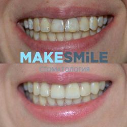 Изображение №2 компании Make smile