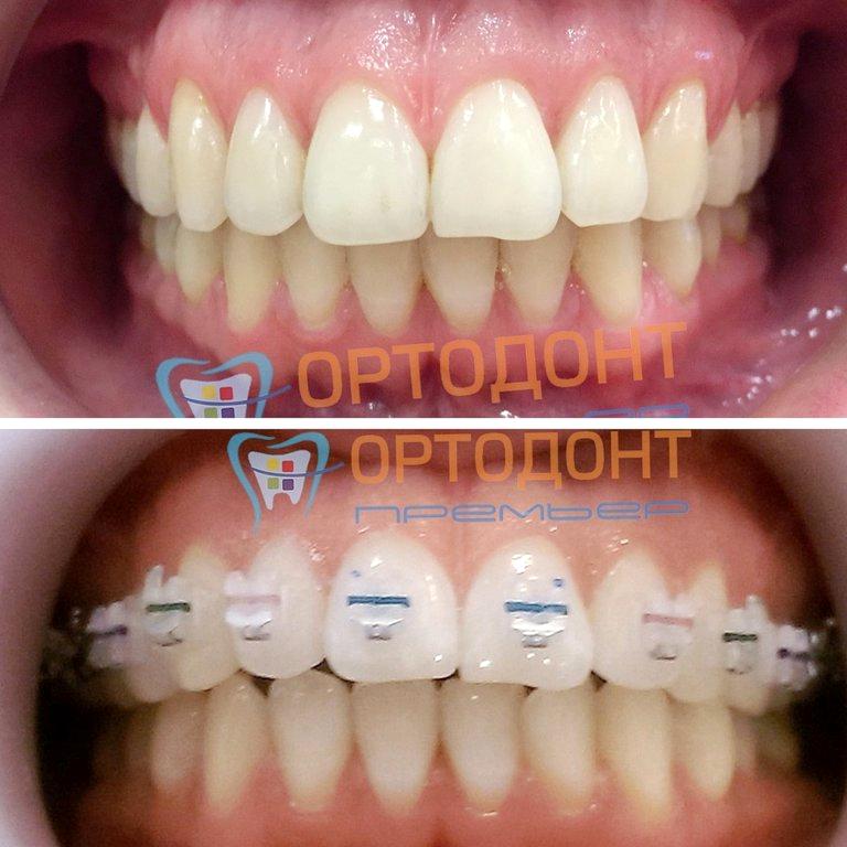 Изображение №7 компании Ортодонт премьер