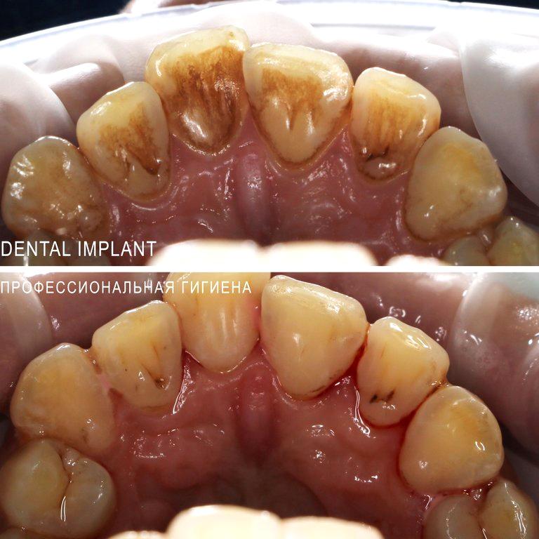 Изображение №7 компании Центр семейной стоматологии Dental Implant