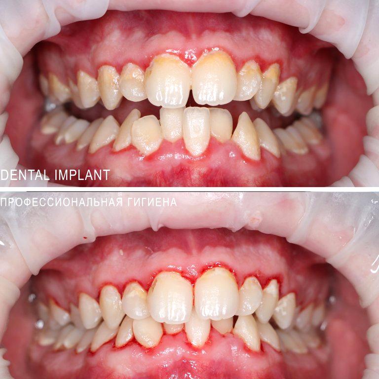 Изображение №12 компании Центр семейной стоматологии Dental Implant