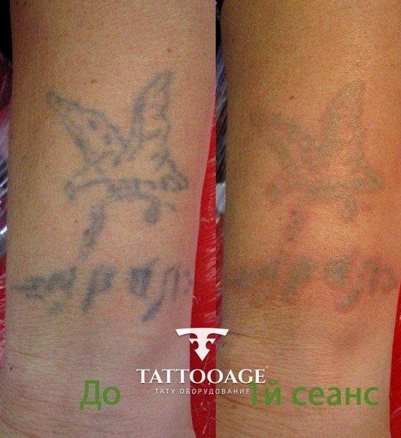 Изображение №5 компании Tattooage