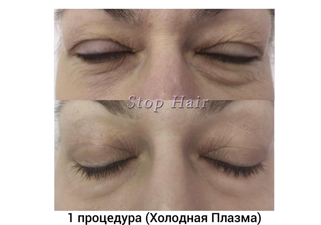 Изображение №17 компании Stop Hair