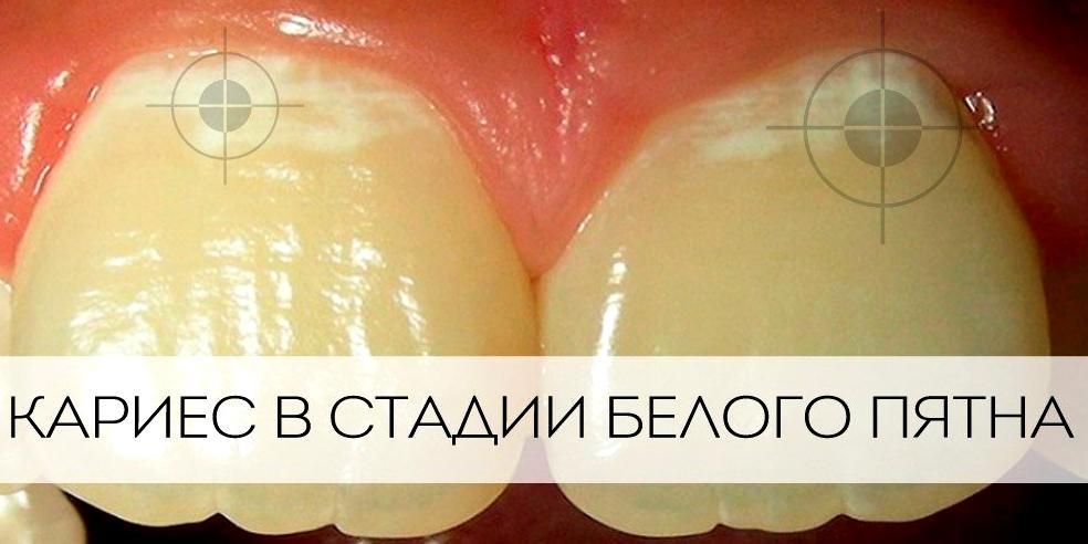 Изображение №7 компании Семейная стоматология на улице Гребенщикова, 13