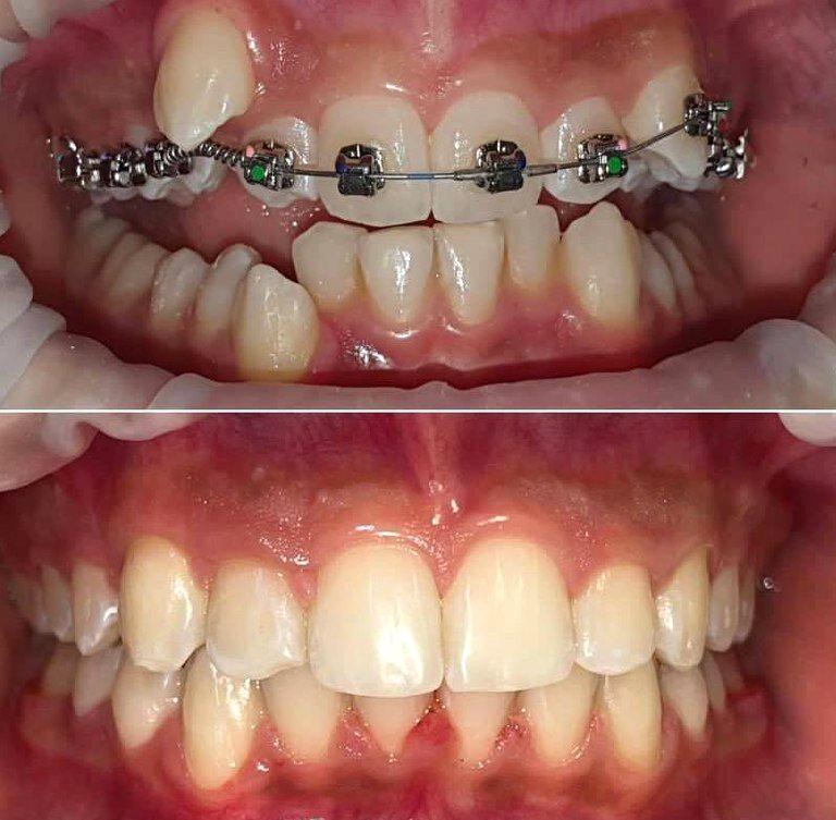 Изображение №10 компании Dr.Kamaev (SL Dental Clinic)