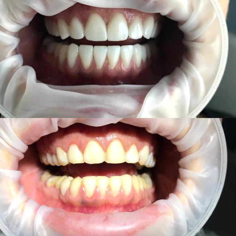 Изображение №19 компании Dr.Kamaev (SL Dental Clinic)