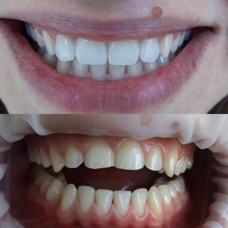 Изображение №18 компании Dr.Kamaev (SL Dental Clinic)