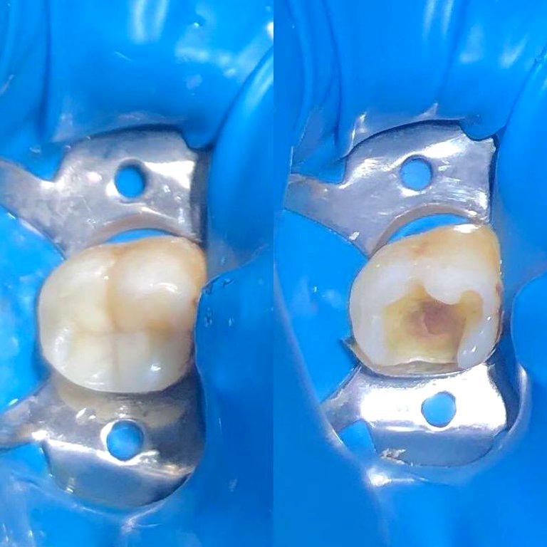 Изображение №16 компании Dr.Kamaev (SL Dental Clinic)