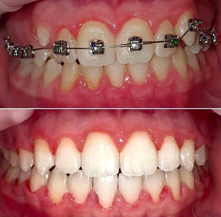 Изображение №20 компании Dr.Kamaev (SL Dental Clinic)