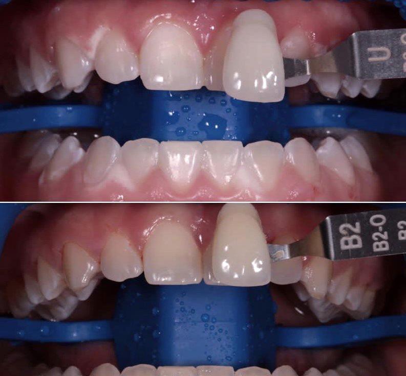 Изображение №12 компании Dr.Kamaev (SL Dental Clinic)
