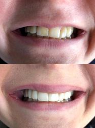 Изображение №4 компании Dr.Kamaev (SL Dental Clinic)