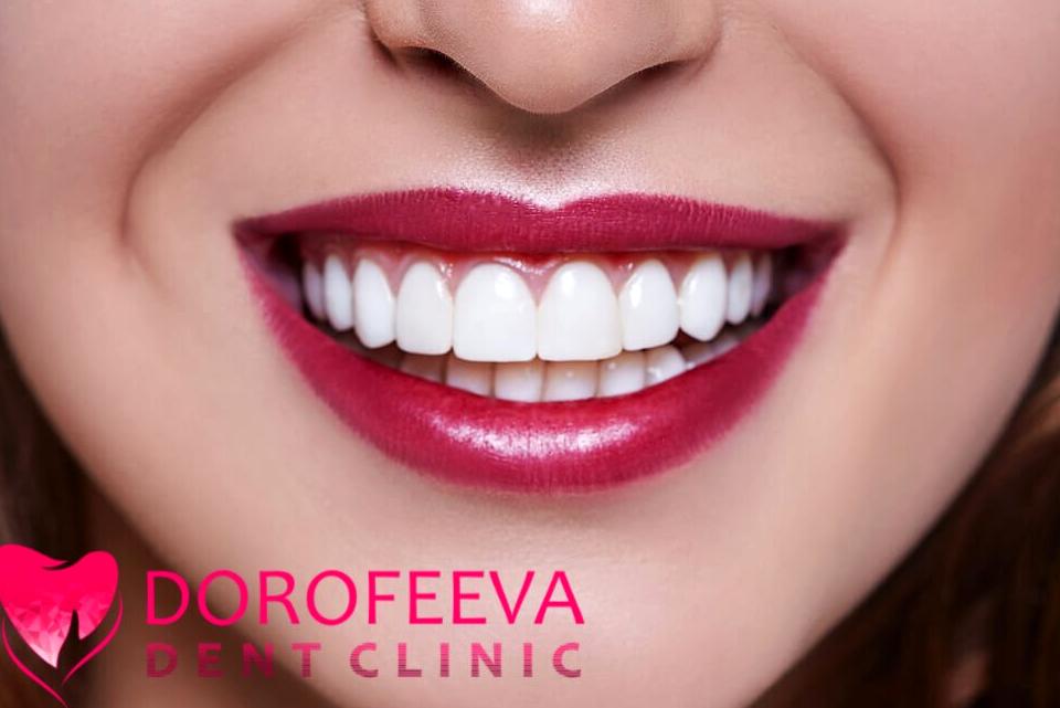 Изображение №18 компании DorofeevaDent Clinic