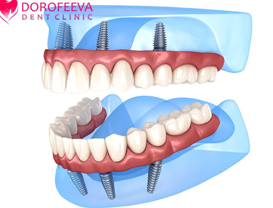 Изображение №13 компании DorofeevaDent Clinic