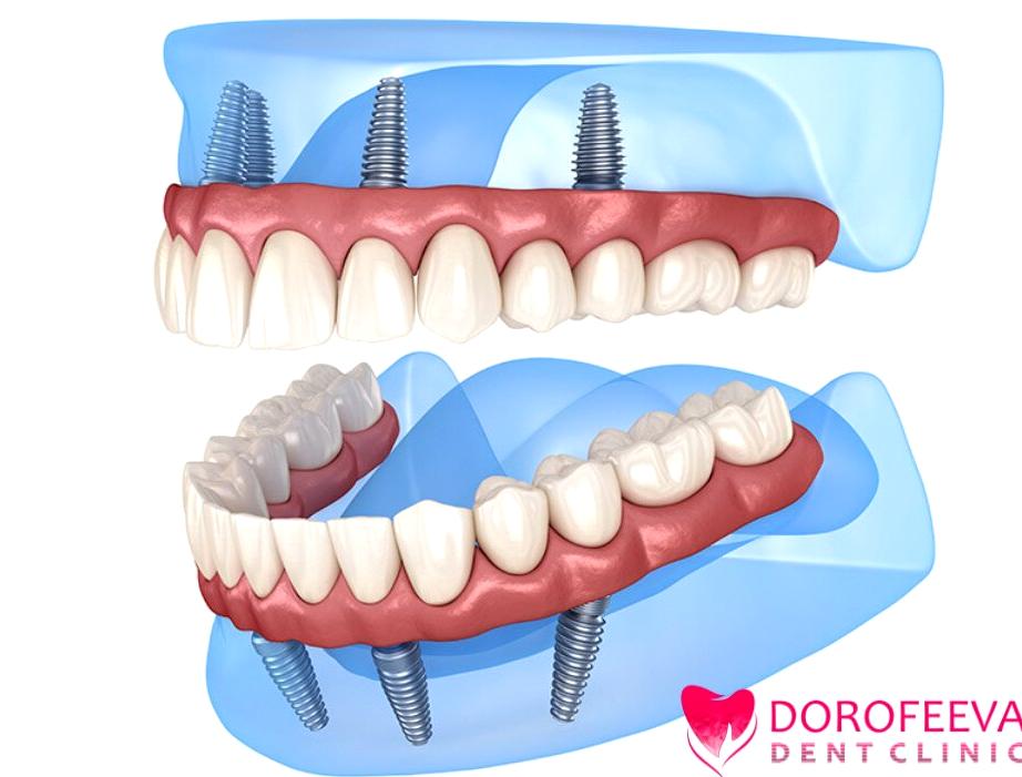 Изображение №15 компании DorofeevaDent Clinic