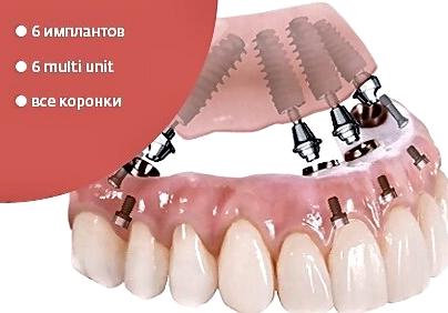 Изображение №12 компании ДОРОФЕЕВА ДЕНТ клиник