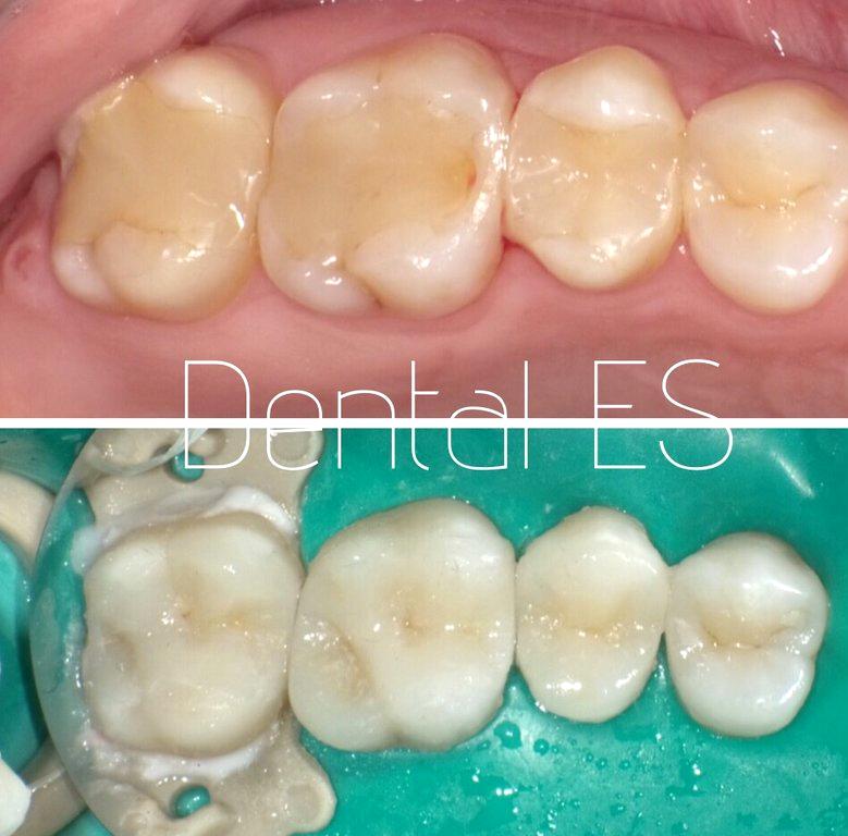 Изображение №6 компании Dental ES