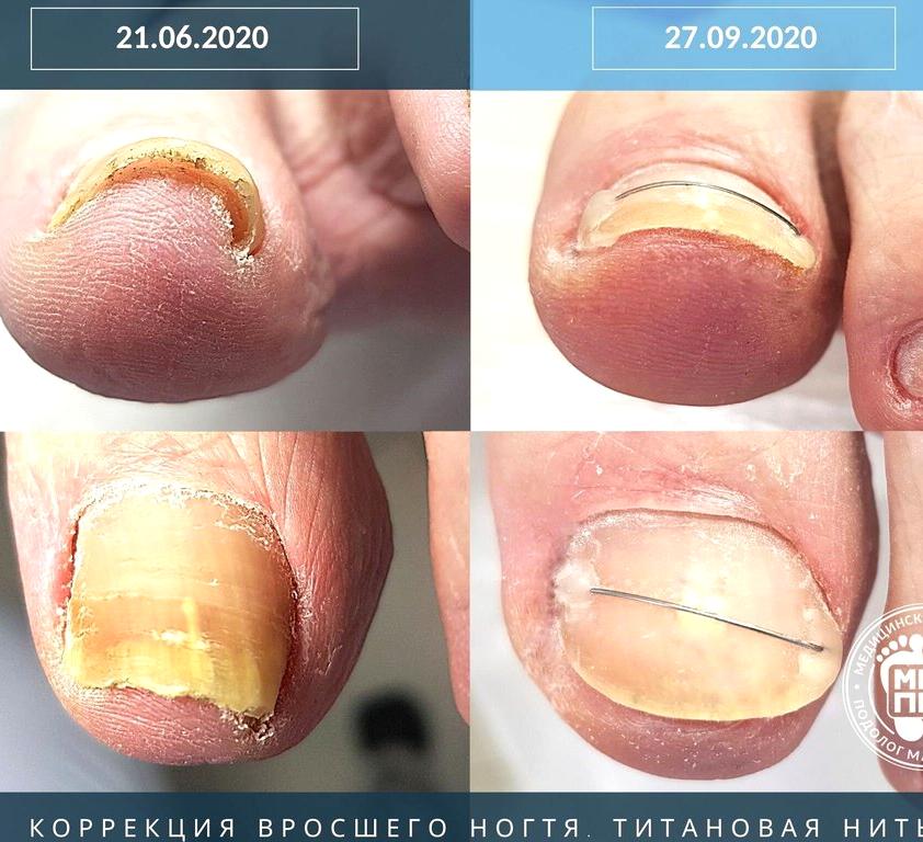 Изображение №9 компании Центр подологии Малиновской