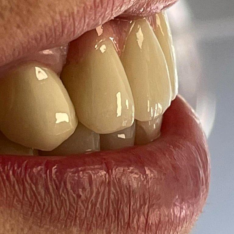 Изображение №13 компании White Smile