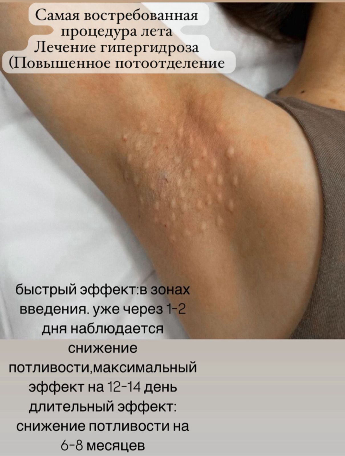 Контурная пластика