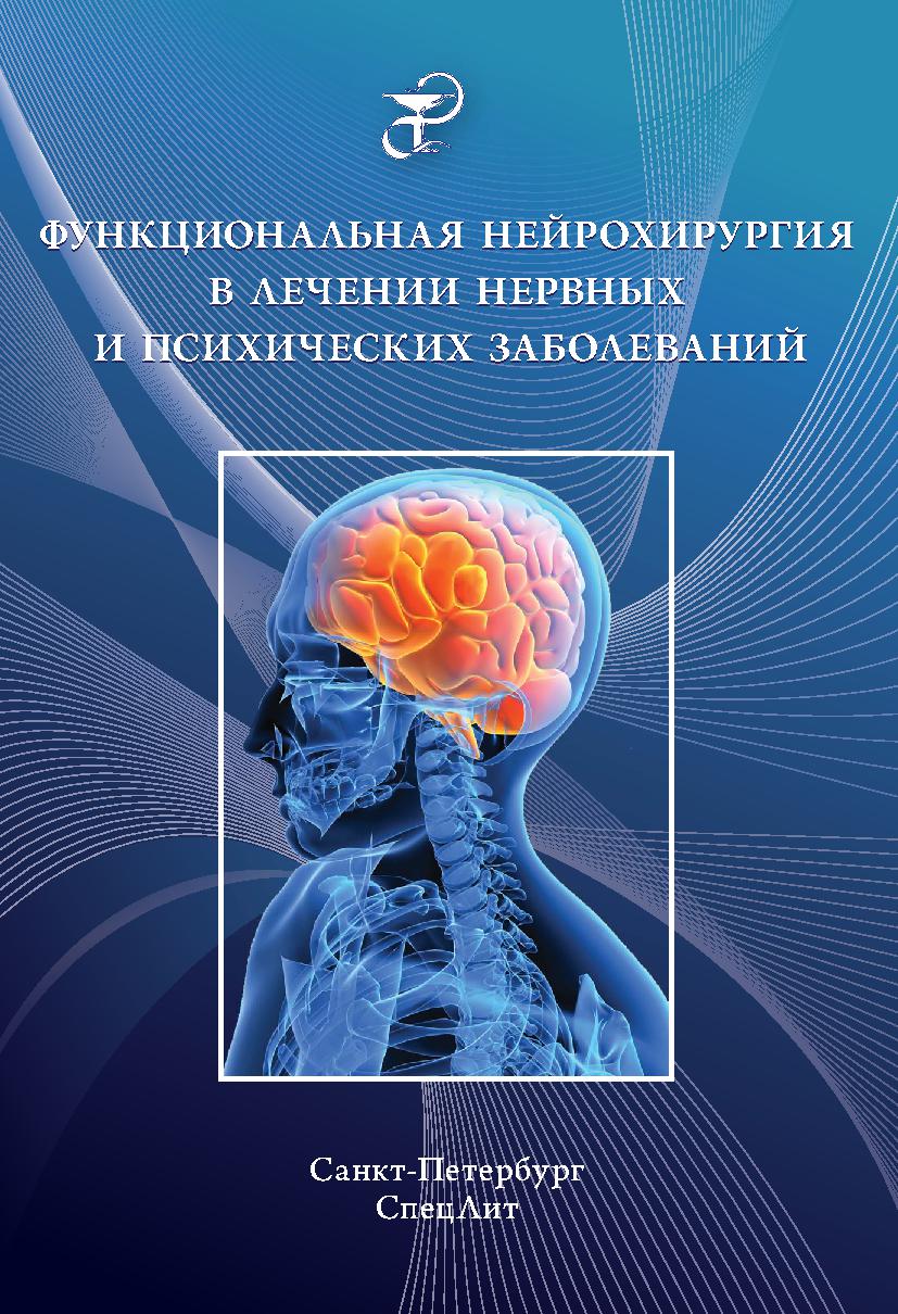 Функциональная нейрохирургия в лечении нервных и психических заболеваний