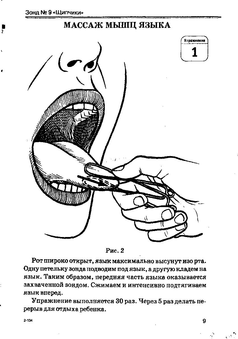 Массаж зондами. Зондовый массаж языка для детей. Зонд для массажа языка. Массаж языка логопедический. Массаж языка зондами для постановки звуков.
