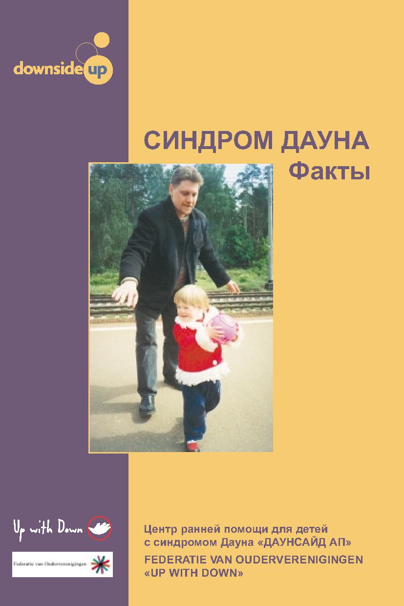 Синдром Дауна. Факты