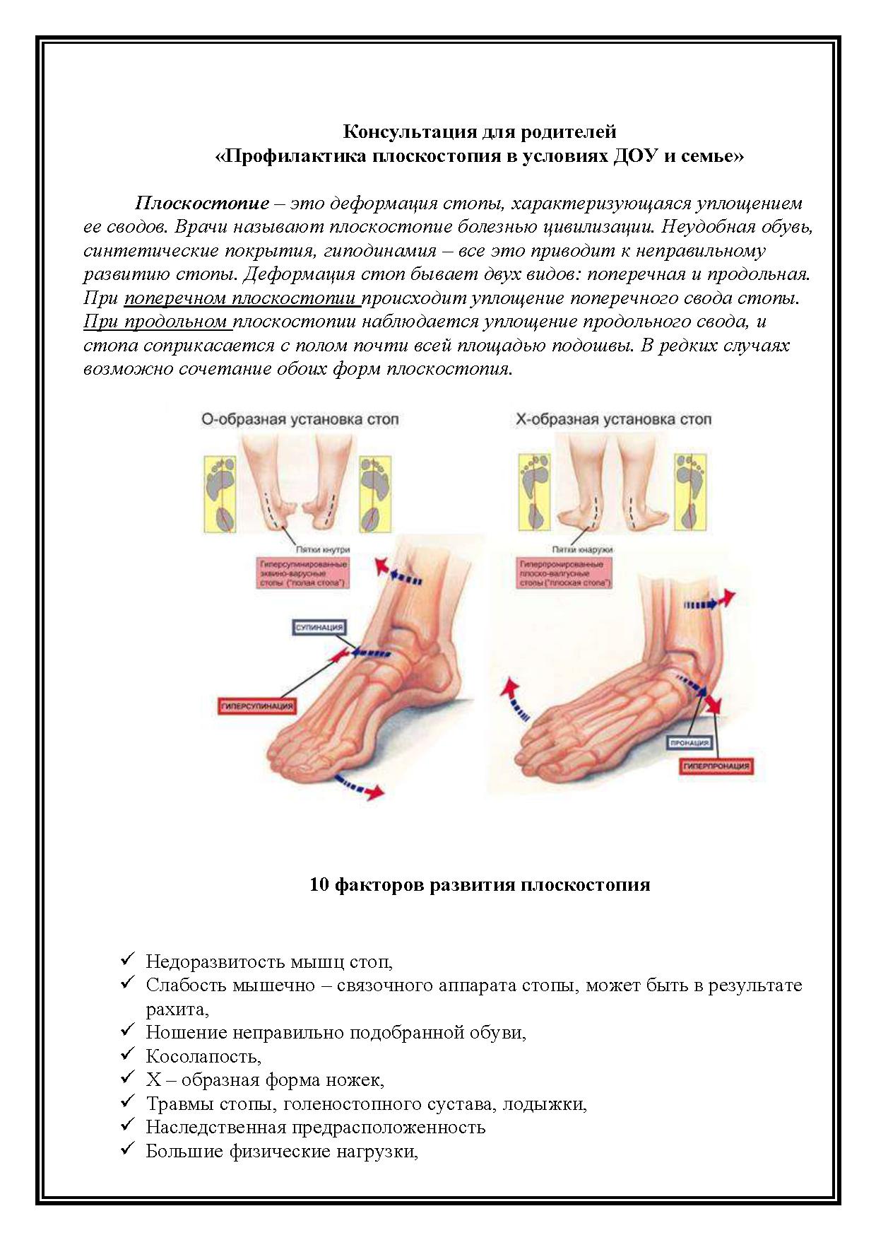 Консультация для родителей «Профилактика плоскостопия в условиях ДОУ и  семье» | Дефектология Проф