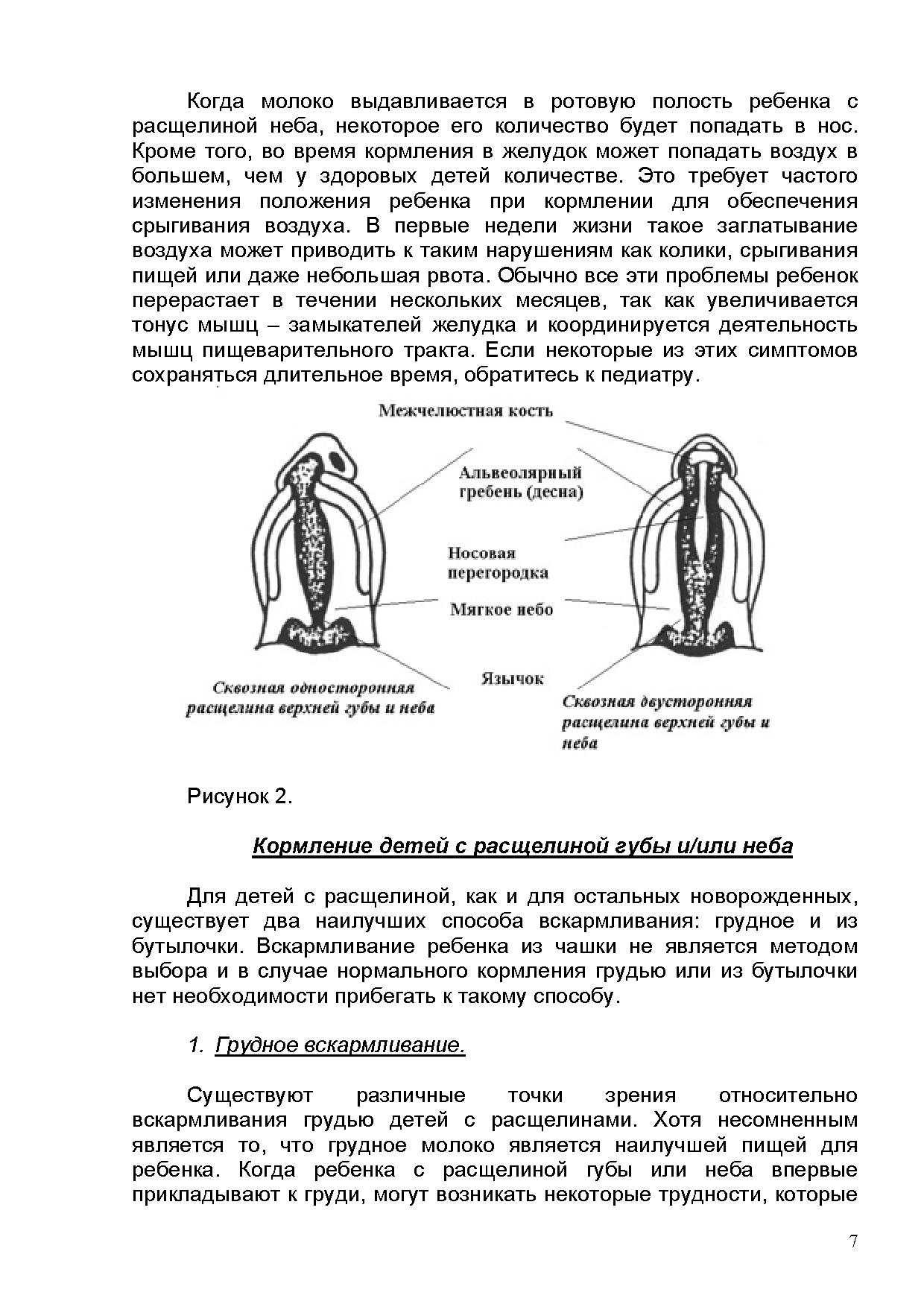 Виды расщелин при ринолалии рисунок