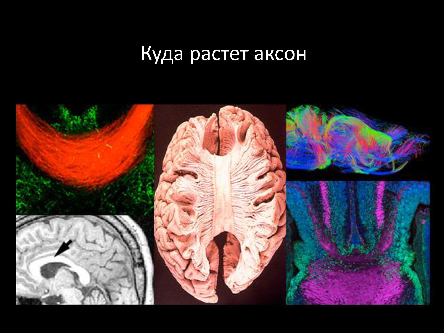 Куда растет аксон — большой секрет