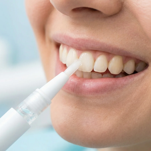 Отбеливающий карандаш