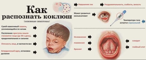 Проявления коклюша - информация