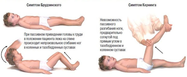 Проявления, используемые в диагностике