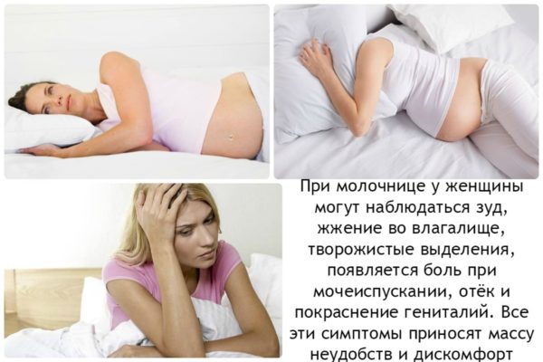 Основные проявления молочницы