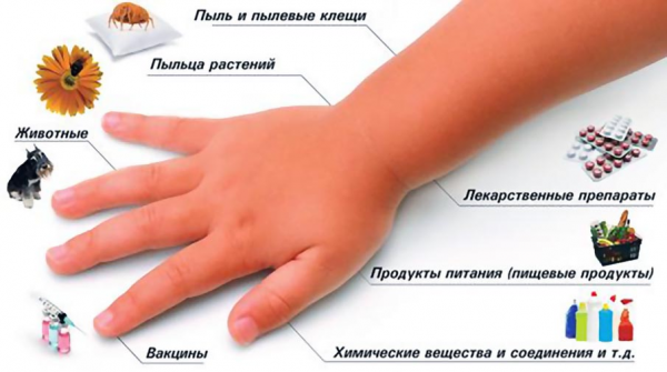 Домашняя аллергия выходит на первое место: как обезопасить себя и детей