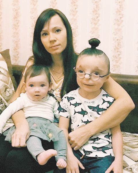 Рустам, мальчик "без лица"