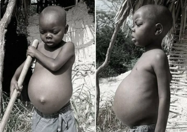 Большие животы у африканских детей