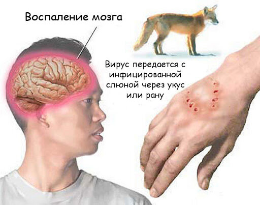 Rabies