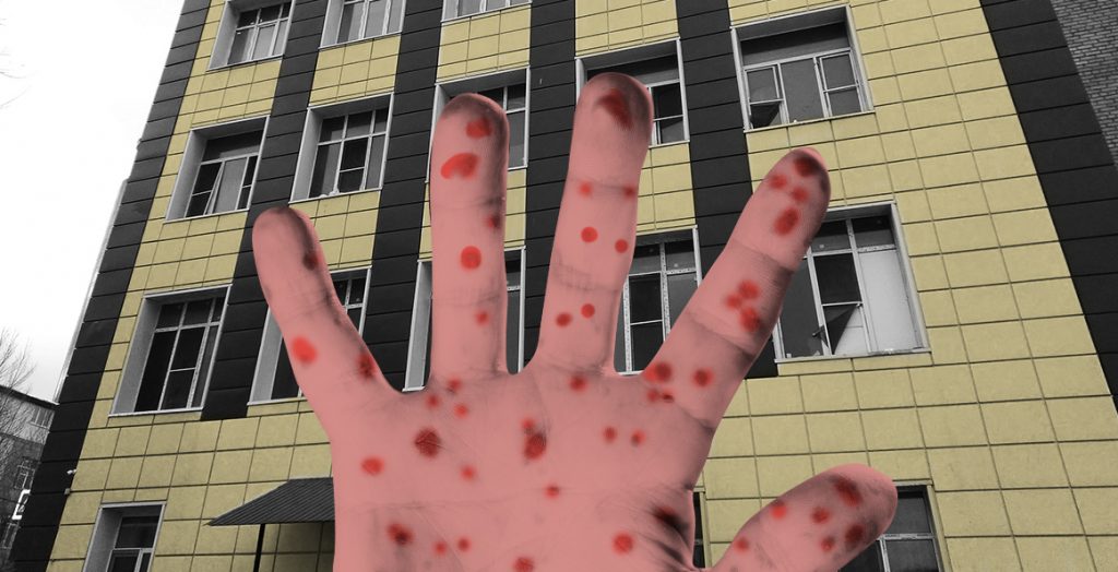 В московском хостеле обнаружили 25 заболевших корью