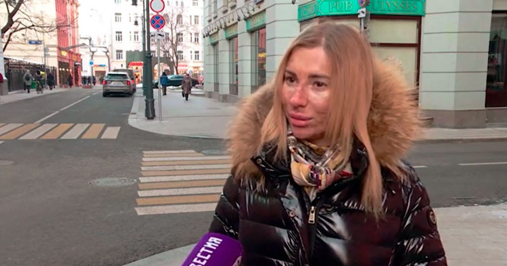 Ожоги вместо омоложения: в салоне на Арбате москвичке сделали неудачную шлифовку
