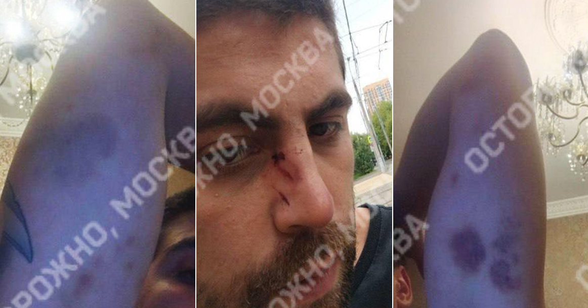 Жителя Москвы избили полицейские, которых он сам и вызвал, чтобы задержать наркомана