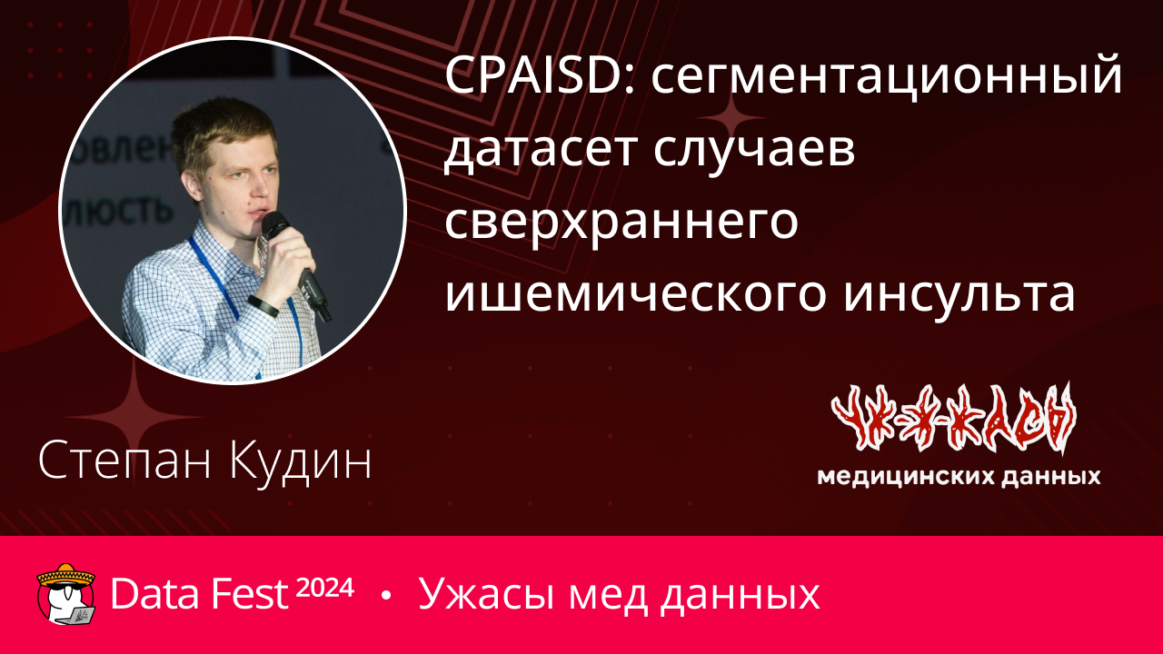 CPAISD: сегментационный датасет случаев сверхраннего ишемического инсульта