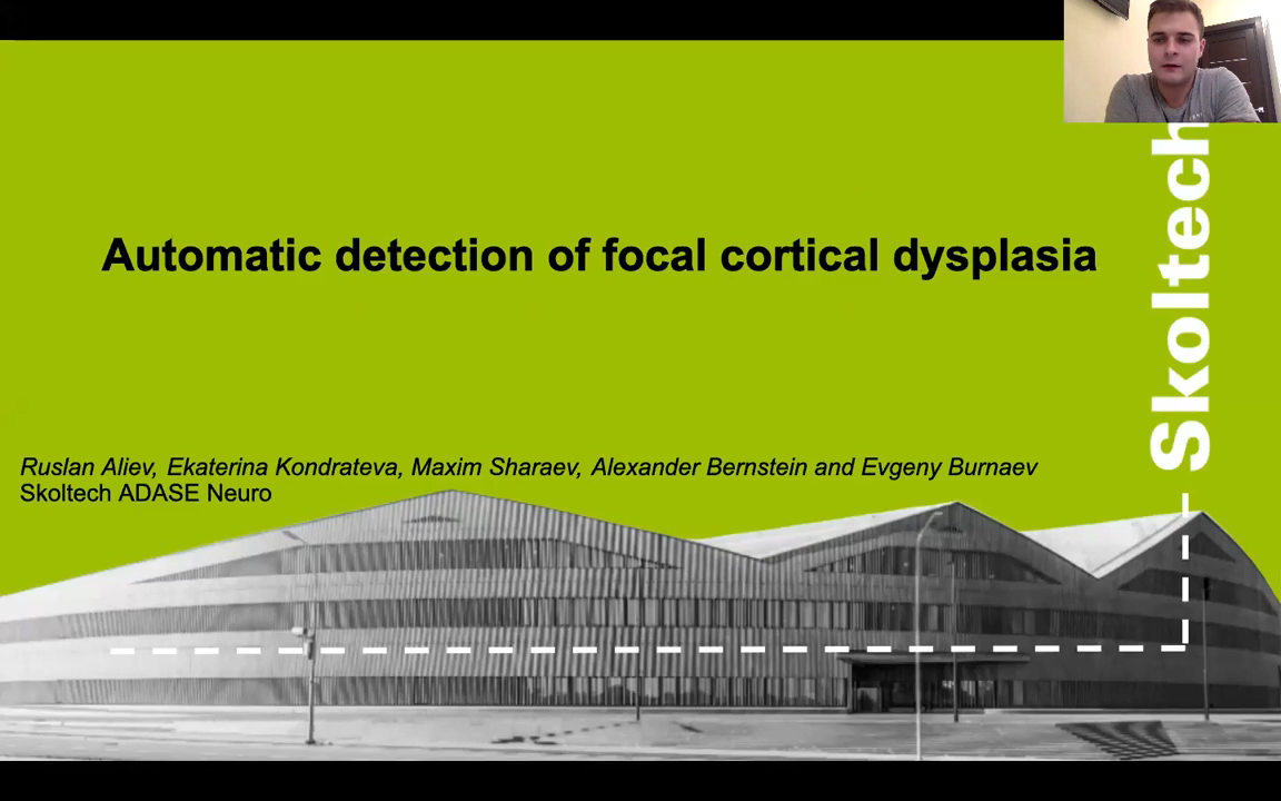 Automatic detection of focal cortical dysplasia