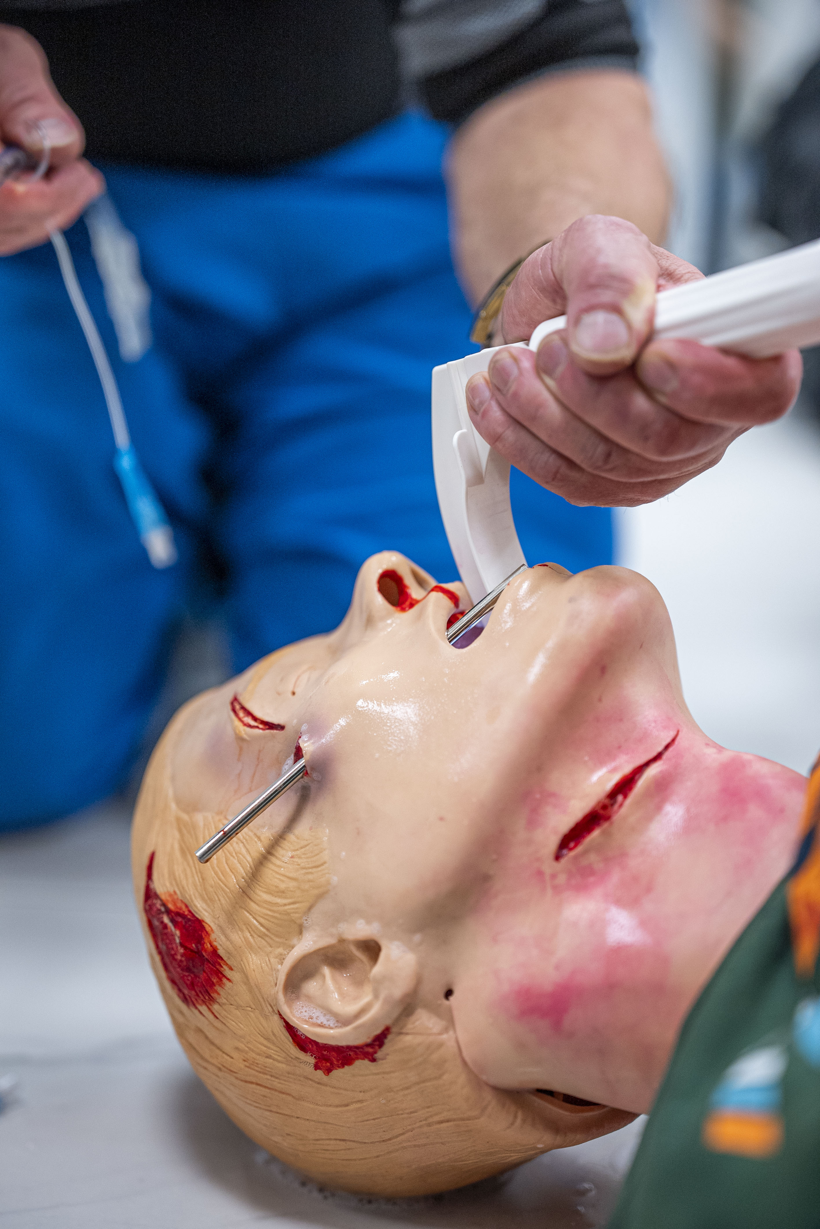 Поддержание проходимости дыхательных путей в критических ситуациях