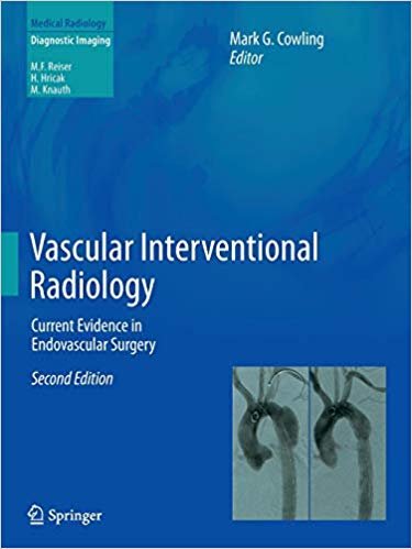 okumak Vascular Interventional Radiology : Current Evidence in Endovascular Surgery