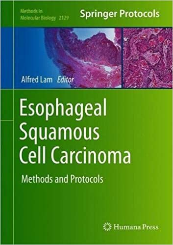 Esophageal Squamous Cell Carcinoma: Methods and Protocols