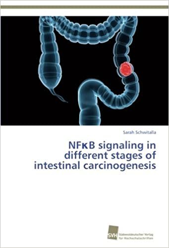 okumak NFκB signaling in different stages of intestinal carcinogenesis