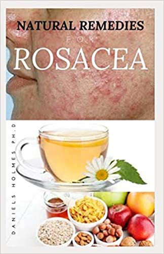 okumak NATURAL REMEDIES FOR ROSACEA: Treating Rosacea with Natural Home Remedies Includes Nose Redness,Acne,Eczema and Lots More