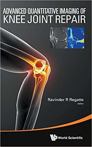 okumak Advanced Quantitative Imaging Of Knee Joint Repair
