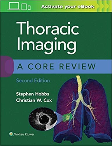 okumak Thoracic Imaging: A Core Review
